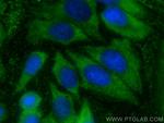 PSPH Antibody in Immunocytochemistry (ICC/IF)