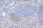 PSPH Antibody in Immunohistochemistry (Paraffin) (IHC (P))