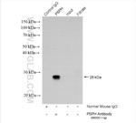 PSPH Antibody in Immunoprecipitation (IP)