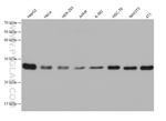 PSPH Antibody in Western Blot (WB)