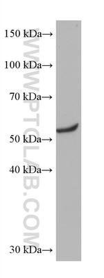 Beta Arrestin 2 Antibody in Western Blot (WB)