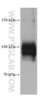 ATP1A1/2 Antibody in Western Blot (WB)