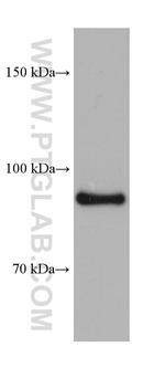 ATP1A1/2 Antibody in Western Blot (WB)