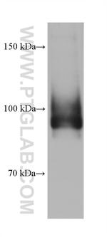 ATP1A1/2 Antibody in Western Blot (WB)
