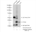 ATP6V0D1 Antibody in Immunoprecipitation (IP)