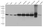 ATP6V0D1 Antibody in Western Blot (WB)