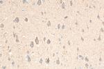 IGFBP5 Antibody in Immunohistochemistry (Paraffin) (IHC (P))