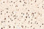 CDK5 Antibody in Immunohistochemistry (Paraffin) (IHC (P))