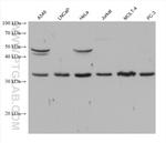 CDK5 Antibody in Western Blot (WB)