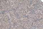 MTHFD2 Antibody in Immunohistochemistry (Paraffin) (IHC (P))