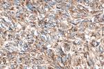 MTHFD2 Antibody in Immunohistochemistry (Paraffin) (IHC (P))