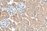 MTHFD2 Antibody in Immunohistochemistry (Paraffin) (IHC (P))