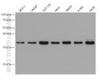 MTHFD2 Antibody in Western Blot (WB)