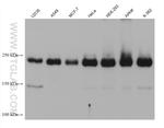 ZC3H13 Antibody in Western Blot (WB)
