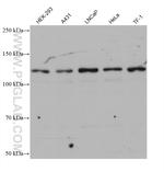 MORC2 Antibody in Western Blot (WB)