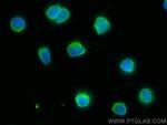 HLA-DRA Antibody in Immunocytochemistry (ICC/IF)
