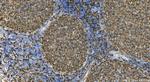 HLA-DRA Antibody in Immunohistochemistry (Paraffin) (IHC (P))
