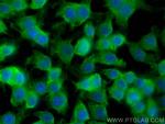 Spermidine synthase Antibody in Immunocytochemistry (ICC/IF)