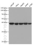 SUCLA2 Antibody in Western Blot (WB)