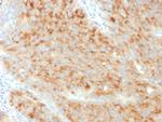 Synaptophysin Monoclonal Antibody (SYP, 3551)