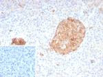 Synaptophysin (Neuroendocrine Marker) Recombinant Mouse Monoclonal Antibody (rSYP/8807)
