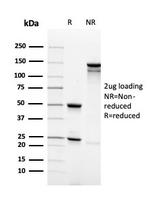 Synaptophysin (Neuroendocrine Marker) Antibody in SDS-PAGE (SDS-PAGE)