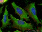 STARD10 Antibody in Immunocytochemistry (ICC/IF)