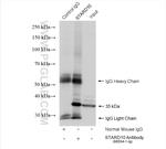 STARD10 Antibody in Immunoprecipitation (IP)