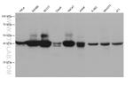 RAD51AP1 Antibody in Western Blot (WB)