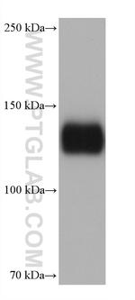 Integrin alpha-5 Antibody in Western Blot (WB)