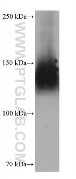 Integrin alpha-5 Antibody in Western Blot (WB)