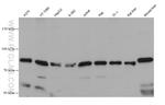 TRPV2 Antibody in Western Blot (WB)