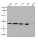 ALAS1 Antibody in Western Blot (WB)