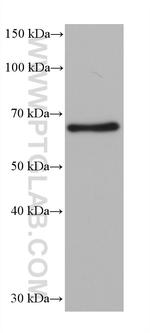 G3BP2 Antibody in Western Blot (WB)