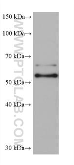 G3BP2 Antibody in Western Blot (WB)