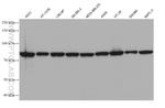 SCNN1A Antibody in Western Blot (WB)