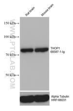 THOP1 Antibody in Western Blot (WB)