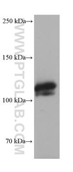 RAG1 Antibody in Western Blot (WB)