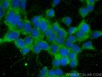 HOMER1 Antibody in Immunocytochemistry (ICC/IF)