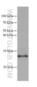 RAB38 Antibody in Western Blot (WB)