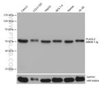 PLAGL2 Antibody in Western Blot (WB)