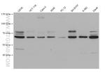 TCF4 Antibody in Western Blot (WB)