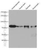 ACSS1 Antibody in Western Blot (WB)
