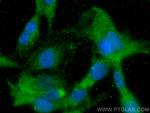 Angiopoietin 1 Antibody in Immunocytochemistry (ICC/IF)