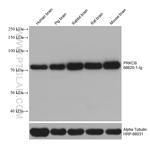 PRKCB Antibody in Western Blot (WB)