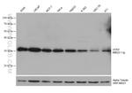UCK2 Antibody in Western Blot (WB)