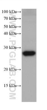 FAHD1 Antibody in Western Blot (WB)