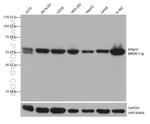 PPM1F Antibody in Western Blot (WB)