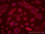 TNNT1 Antibody in Immunocytochemistry (ICC/IF)