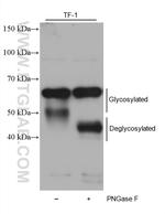 ST6GAL1 Antibody in Western Blot (WB)